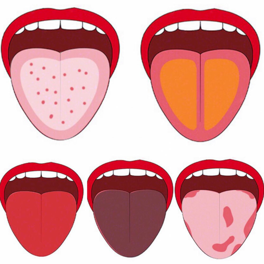 快照鏡子看看自己的舌苔！從顏色就能推測出身體潛在毛病，妳是哪一種？